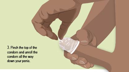Pinch the top of the condom and unroll the condom all the way down your penis.