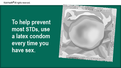 To help prevent most STDs, use a latex condom every time you have sex.