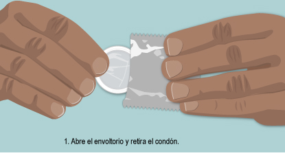 Abre el envoltorio y retira el condón.
