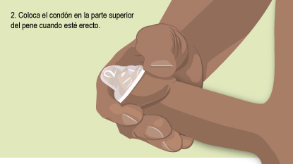 Coloca el condón en la parte superior del pene cuando esté erecto.