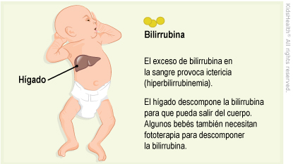 Illustration: hyperbilirubinemia 